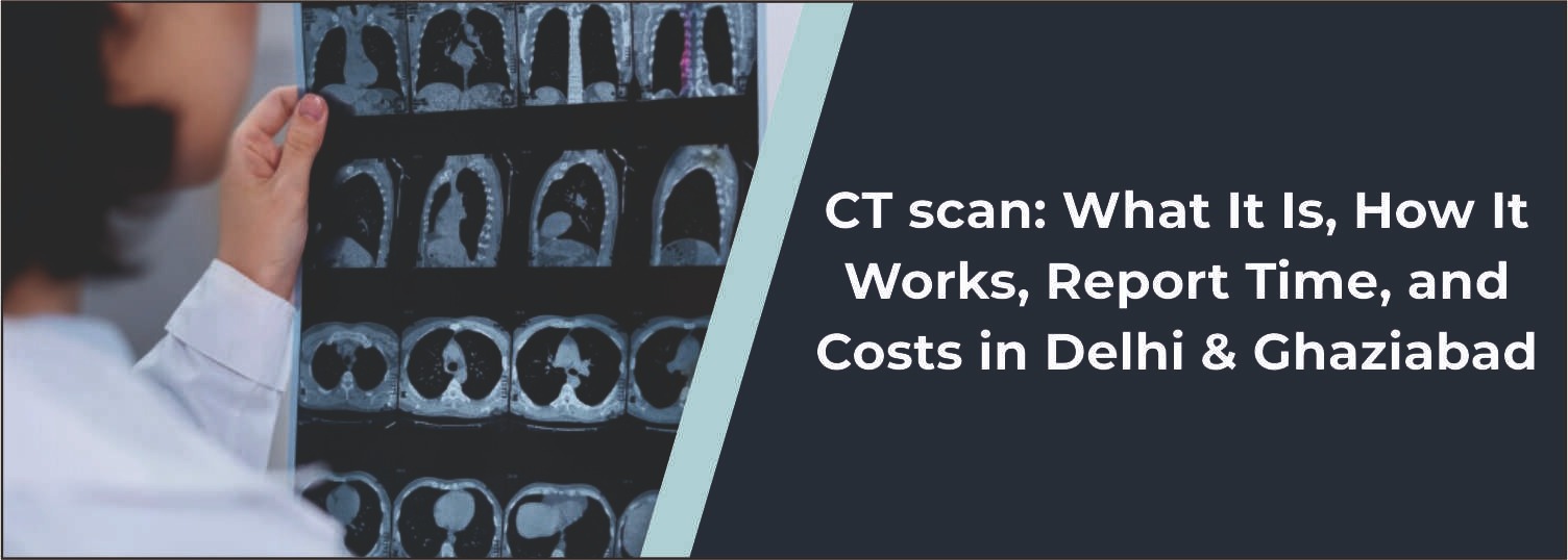 CT Scan: What It Is, How It Works, Report Time, and Costs in Delhi & Ghaziabad