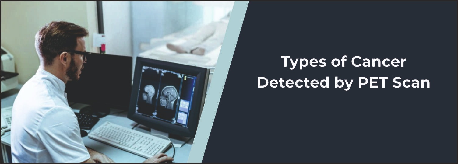 Types of Cancer Detected by PET Scan