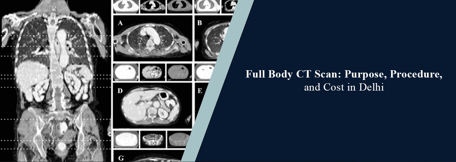 Full Body CT Scan: Purpose, Procedure, and Cost in Delhi