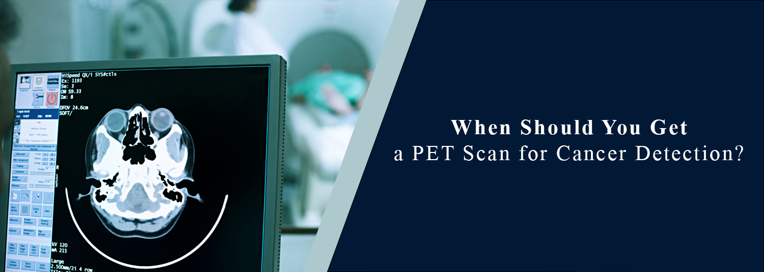 When Should You Get a PET Scan for Cancer Detection?