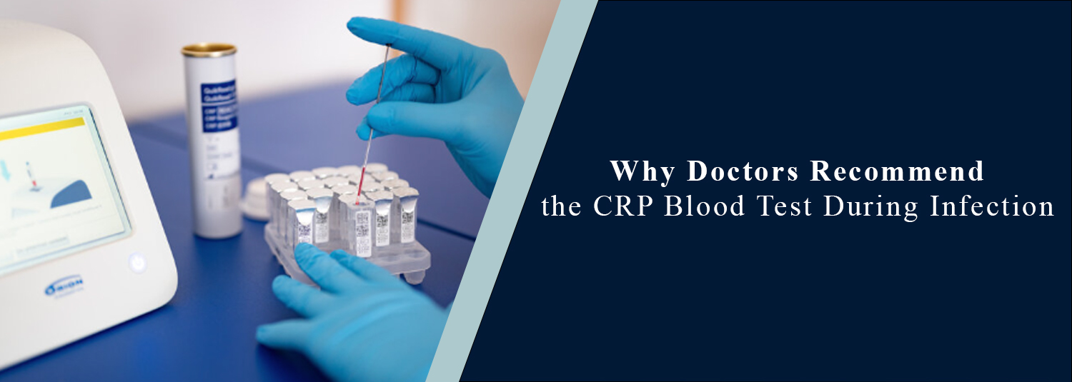 Why Doctors Recommend the CRP Blood Test During Infection?
