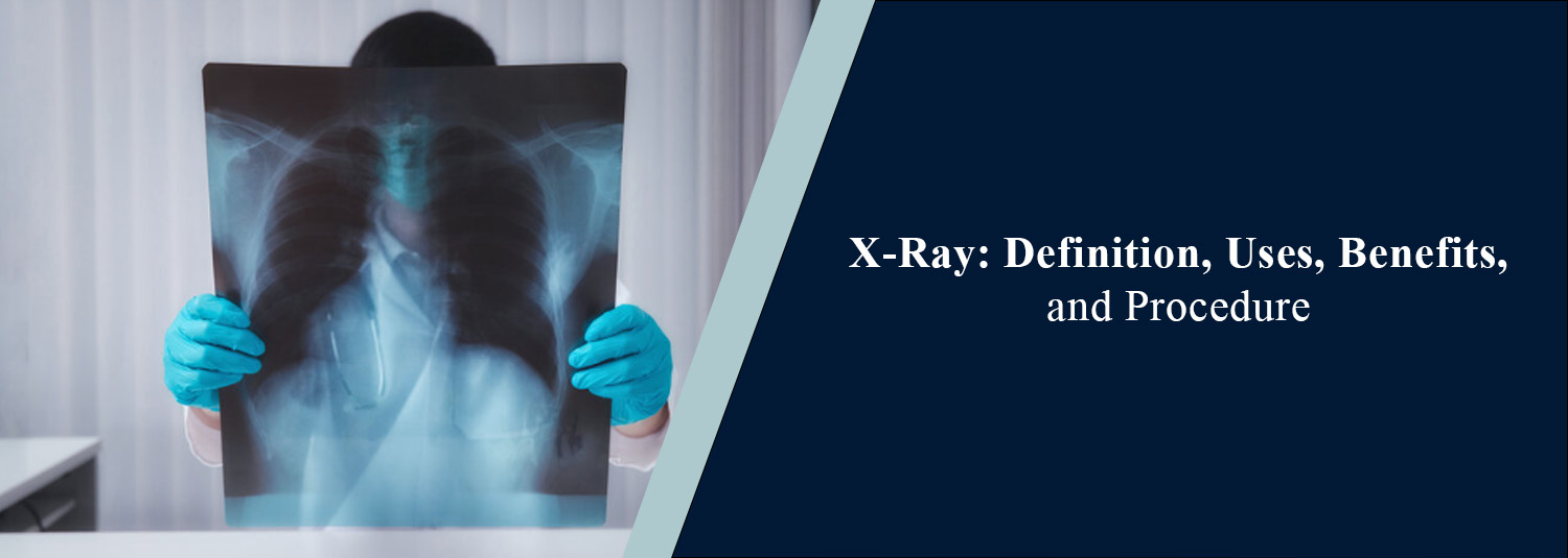 X-Ray: Definition, Uses, Benefits, and Procedure