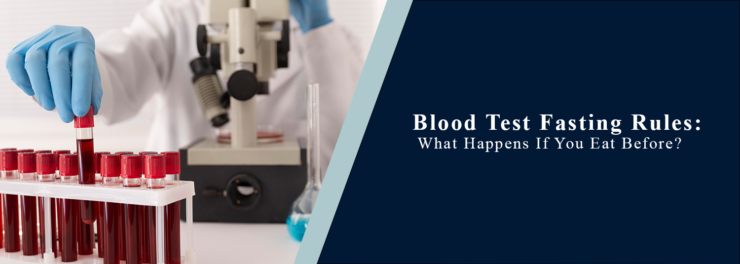 Blood Test Fasting Rules: What Happens If You Eat Before?