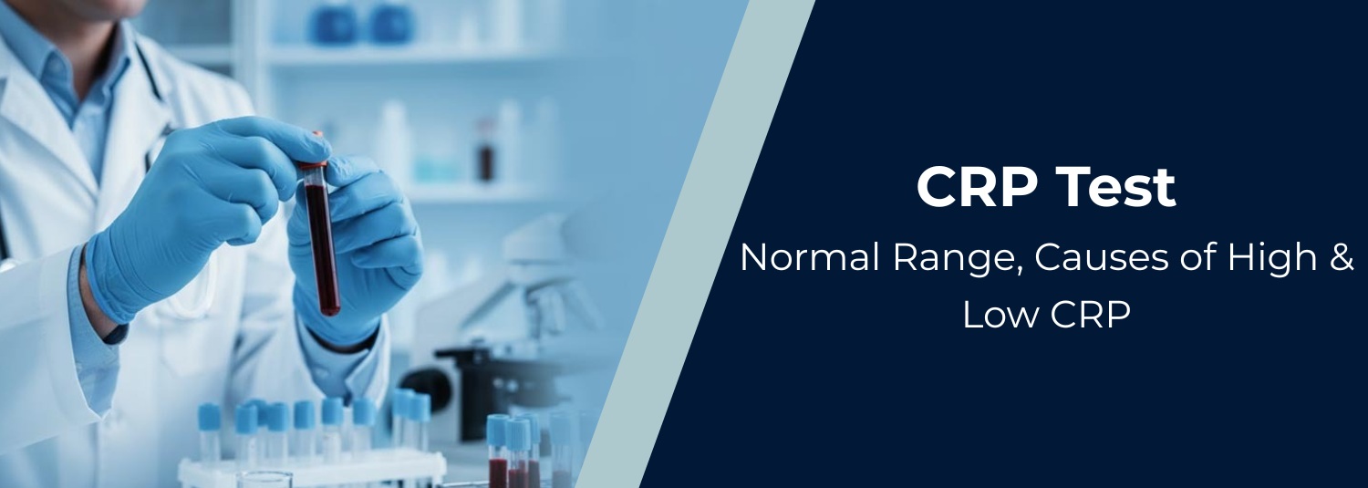 CRP Test: Normal Range, Causes of High & Low CRP