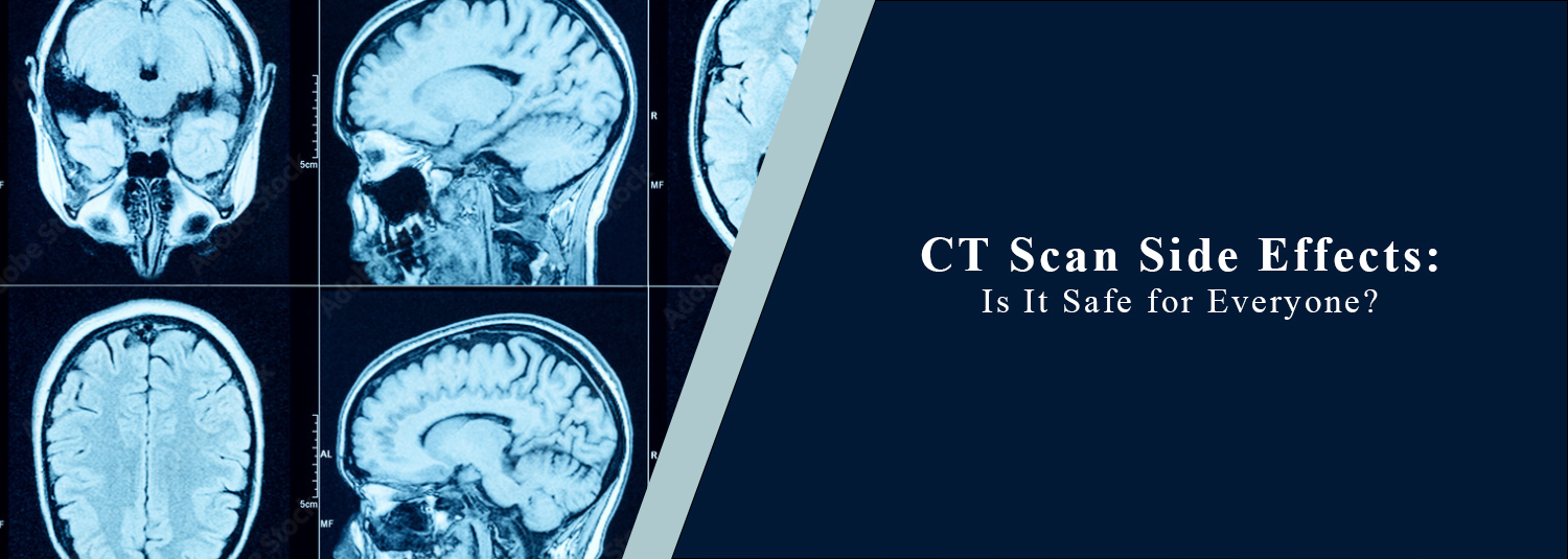 CT Scan Side Effects: Is It Safe for Everyone?