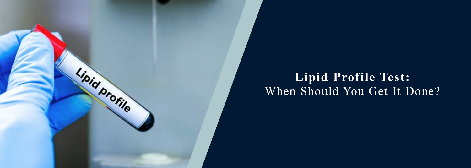 Lipid Profile Test: When Should You Get It Done?