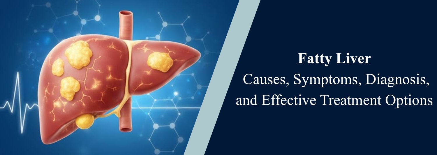 Fatty Liver: Causes, Symptoms, Diagnosis, and Effective Treatment Options