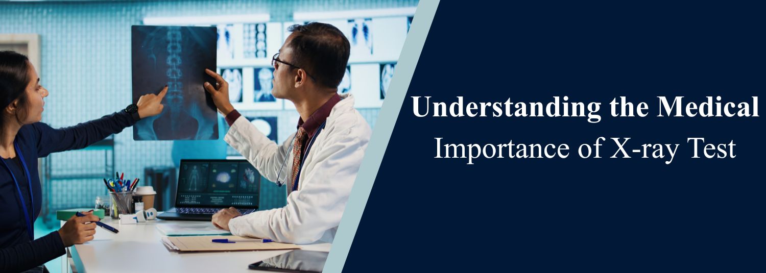 Understanding the Medical Importance of X-ray Test