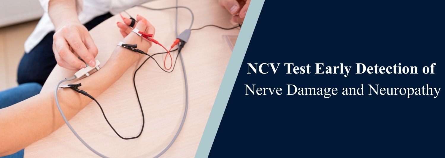 NCV Test Early Detection of Nerve Damage and Neuropathy