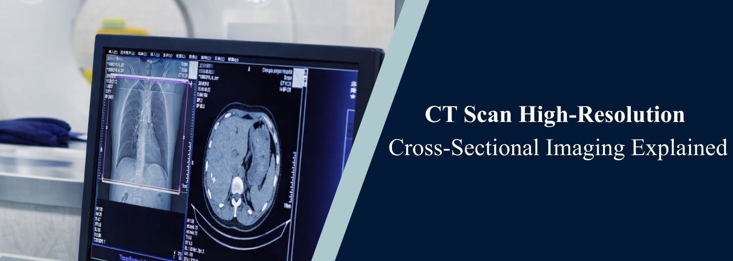 CT Scan High-Resolution Cross-Sectional Imaging Explained