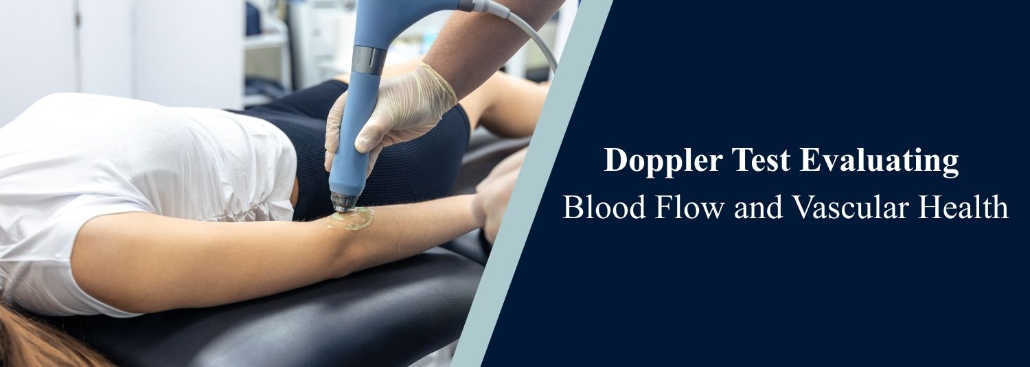 Doppler Test Evaluating Blood Flow and Vascular Health