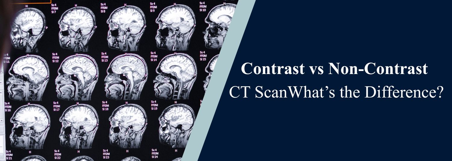 Contrast vs Non-Contrast CT Scan: What’s the Difference?