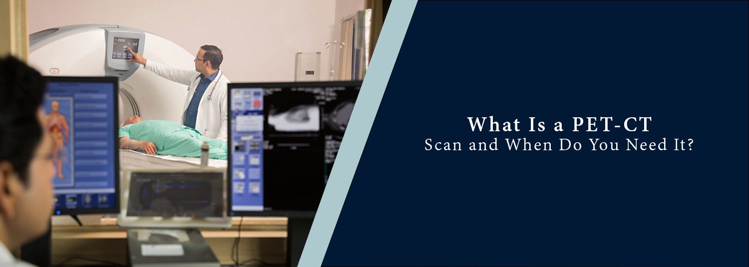 What Is a PET-CT Scan and When Do You Need It?