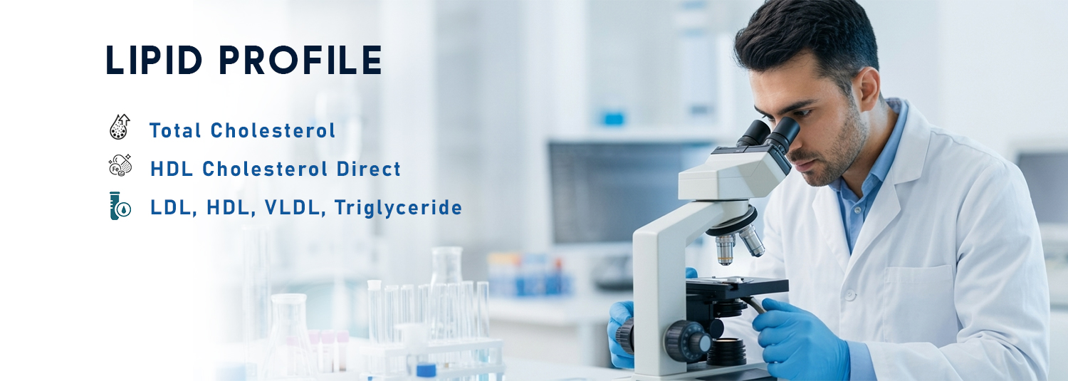 Lipid Profile