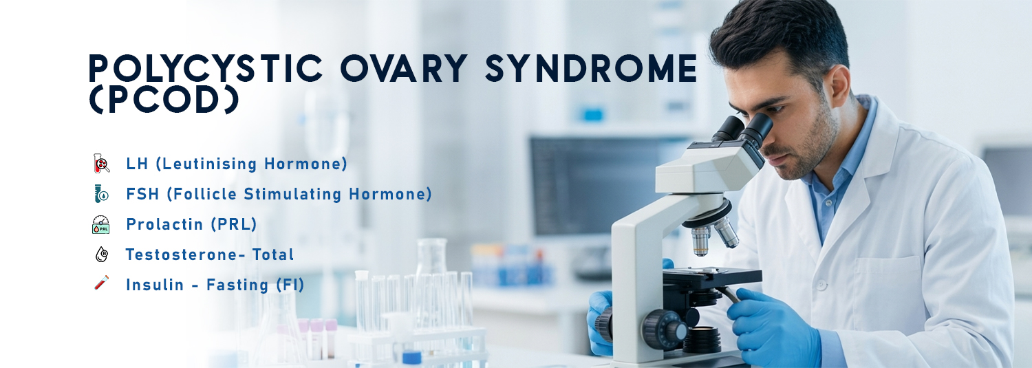 Polycystic ovary syndrome (PCOD)
